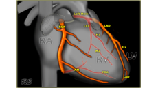Tìm hiểu về cấu trúc và tuần hoàn của hệ động mạch vành