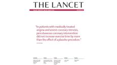 Nghiên cứu ORBITA 2018 về hiệu quả của can thiệp mạch vành qua da ở bệnh nhân đau thắt ngực ổn định