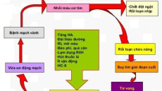 Các yếu tố nguy cơ gây bệnh mạch vành bạn nên biết