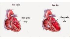 Chăm sóc bệnh nhân suy tim thế nào là đúng cách?
