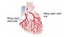 Động mạch vành là gì ? Khái niệm về hệ động mạch vành