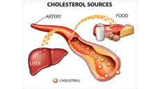 Mối liên hệ giữa cholesterol và bệnh tim mạch