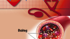 Nhận thức đúng về mối liên quan giữa Tăng huyết áp và Đái tháo đường