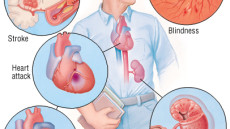 Ảnh hưởng của tăng huyết áp với cơ thể