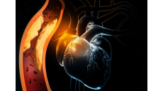 Quản lý hội chứng động mạch vành mạn trong một số bệnh cảnh đặc thù