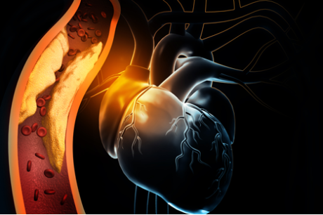 Quản lý hội chứng động mạch vành mạn trong một số bệnh cảnh đặc thù