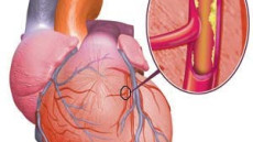 Tại sao rối loạn lipid máu gây nguy hiểm? (Phần 3)