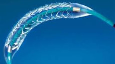 Chỉ định dùng stent phủ thuốc (DES) và stent thông thường (BMS)