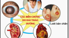 Biến chứng của bệnh tiểu đường có nguy hiểm không?