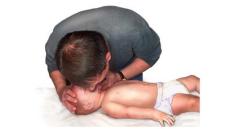 Cấp cứu tim ngừng đập ở trẻ nhỏ