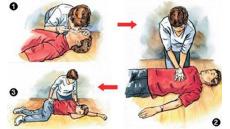 Cấp cứu tim ngừng đập ở người lớn