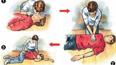 Cấp cứu tim ngừng đập ở người lớn
