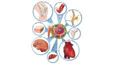 Triển vọng của phương pháp sử dụng tế bào gốc trong các bệnh tim mạch