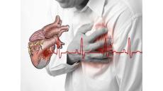 Xơ vữa động mạch là gì và có nguy hiểm không?