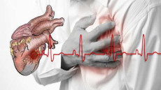 Xơ vữa động mạch là gì và có nguy hiểm không?