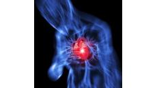 Bạn nên làm gì khi nghi ngờ bị nhồi máu cơ tim?