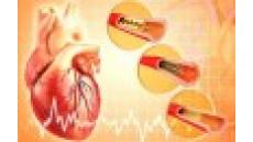 Không còn lo phải đặt thêm stent mạch vành