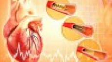 Không còn lo phải đặt thêm stent mạch vành