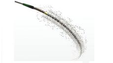 Tư vấn: Đặt stent động mạch vành phủ thuốc được bao lâu?