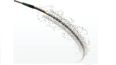 Tư vấn: Đặt stent động mạch vành phủ thuốc được bao lâu?