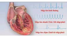 Tư vấn: Nhịp tim thường xuyên 90 nhịp/phút có làm sao không?