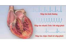 Tư vấn: Nhịp tim thường xuyên 90 nhịp/phút có làm sao không?