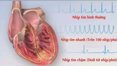 Tư vấn: Nhịp tim thường xuyên 90 nhịp/phút có làm sao không?