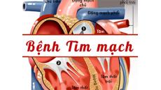 Bệnh tim mạch là gì?