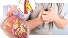 Bác sĩ tim mạch lưu ý các dấu hiệu cảnh báo tắc động mạch vành 