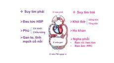 Những hiểu biết cơ bản về suy tim phải bạn nên biết