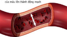 Chỉ số huyết áp bao nhiêu là cao và nguy hiểm?