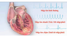 Nhịp tim bình thường và cách đếm nhịp tim đúng cách từ Bác sĩ tim mạch