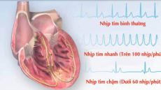Nhịp tim bình thường và cách đếm nhịp tim đúng cách từ Bác sĩ tim mạch