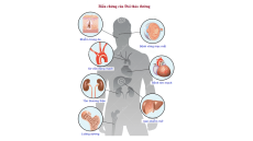 Bệnh tiểu đường và các cách phòng ngừa