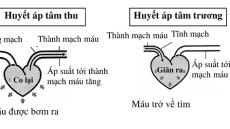 Tăng huyết áp tâm thu đơn độc, nguy cơ và giải pháp
