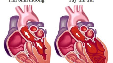 Tìm hiểu về cơ chế suy tim
