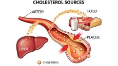 Rối loạn lipid máu và nguy cơ bệnh tim mạch