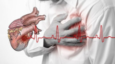 Triệu chứng thiếu máu cơ tim không thể bỏ qua