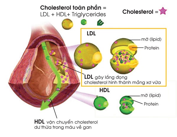 Mối liên hệ giữa cholesterol và bệnh tim mạch