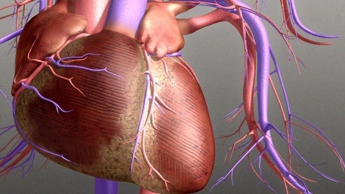 Hiểu và dùng đúng thuốc trợ tim trong bệnh suy tim sung huyết