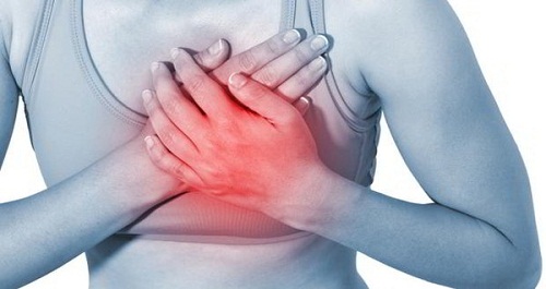 Vị trí đau thắt ngực trong bệnh mạch vành