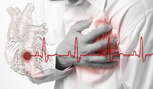 Hồi hộp đánh trống ngực có phải là bị bệnh tim mạch không?
