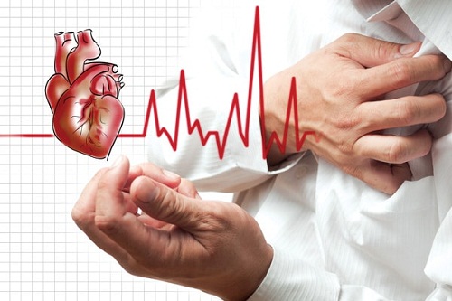 Cấp cứu nhồi máu cơ tim như thế nào trong 6 giờ đầu?