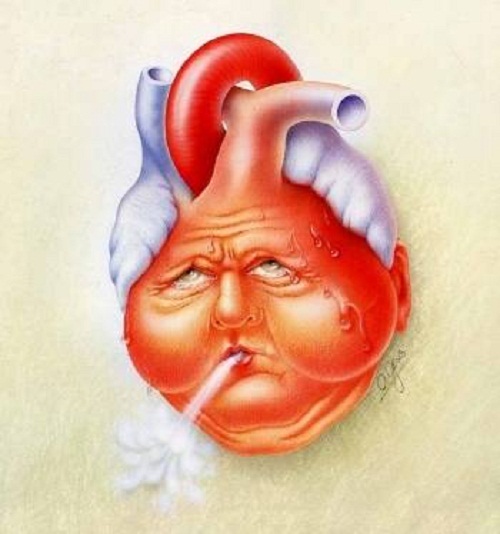 Sự khác nhau giữa nhồi máu cơ tim và suy tim bạn nên biết