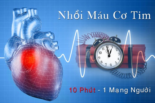 Nhịp tim bất thường có thể là dấu hiệu của bệnh nhồi máu cơ tim