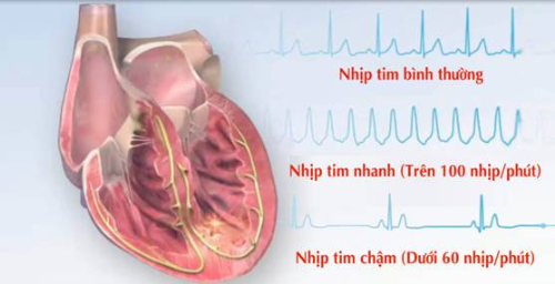 Nhịp tim bình thường và cách đếm nhịp tim đúng cách